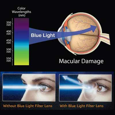 Damages caused by blue radiation HEV